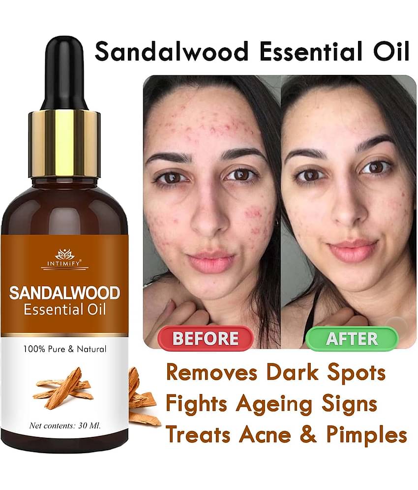 Intimify Sandalwood Essential Oil, Dark Spots Removal, Acne Removal Face Oil, Anti Wrinkle, 30 Ml