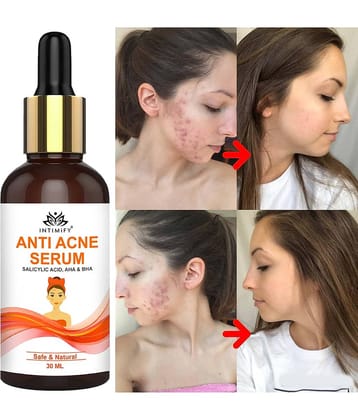 Intimify Anti Acne Face Serum, Anti Ageing, Skin Brightening, Acne Removal, 30 Ml