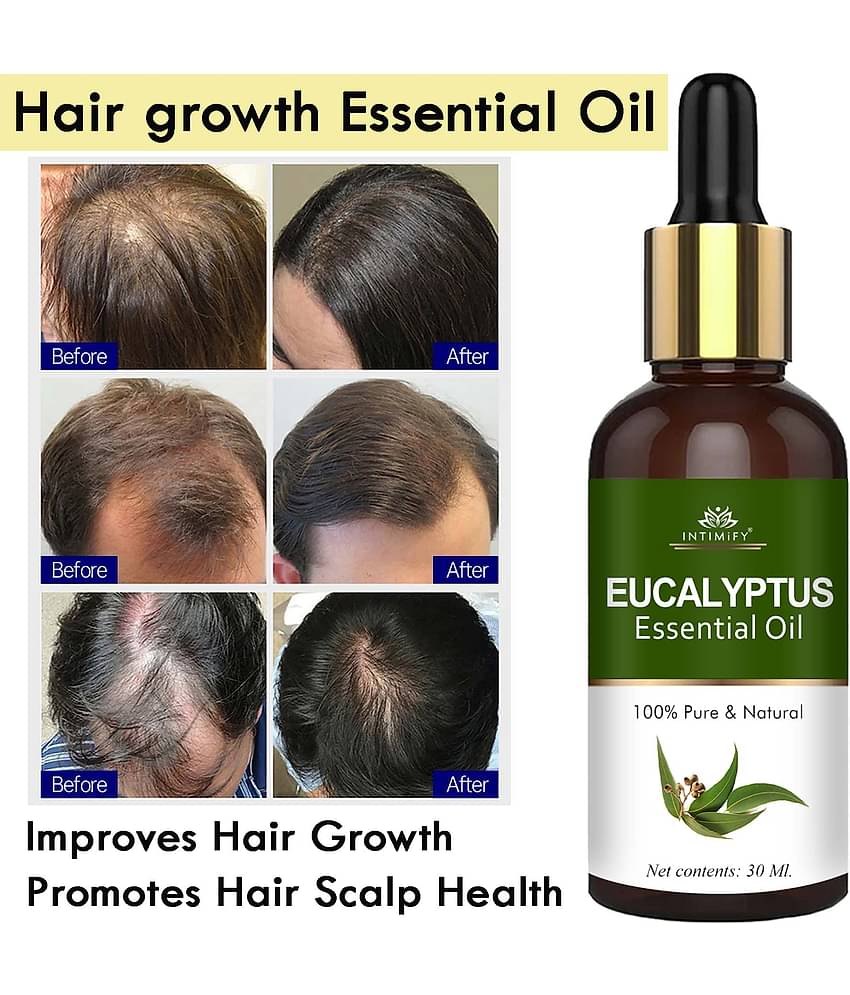 Intimify Eucalyptus Essential Oil, Hair Inhabiter Oil, Hair Loss Oil, Hair Growth Oil, 30 Ml