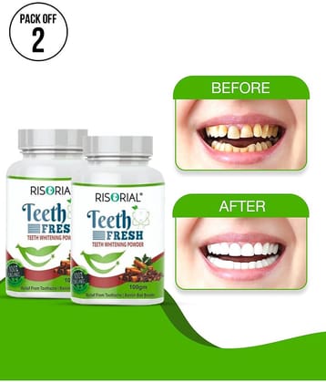 Latibule Teeth Whitening Denture Oral Kit Pack of 2