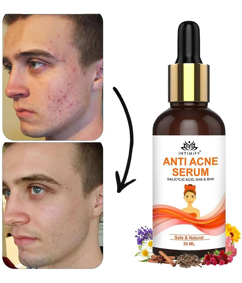 Intimify Anti Acne Serum, Face Serum For Skin Whitening, Skin Brightening Serum 30 ml
