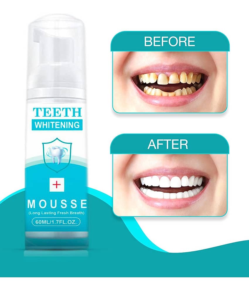 Gantavya Advance Teeth Whitening,  Deep Cleanser Denture Oral Kit