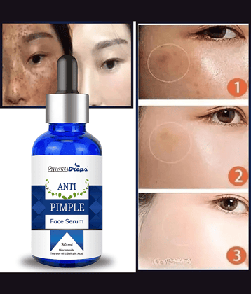 Smartdrops Face Serum Glycolic Acid Radiant Glow For Oily Skin ( Pack of 1 )
