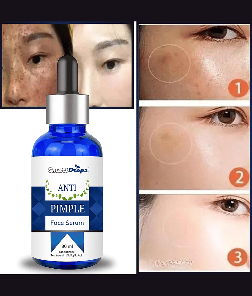 Smartdrops Face Serum Glycolic Acid Radiant Glow For Oily Skin ( Pack of 1 )