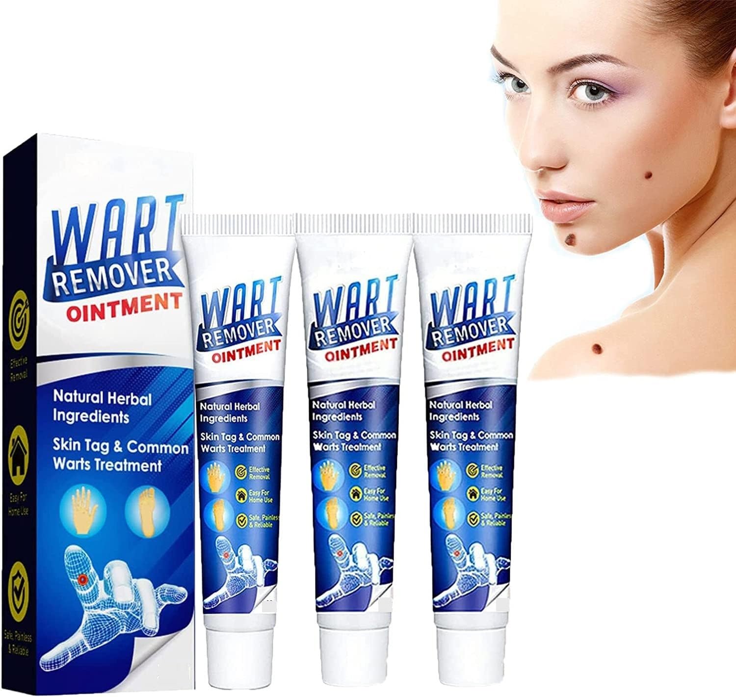 Elecsera Unique Cream Warts Remover Ointment Skin Tag Removal Pack of 3 (100 g)