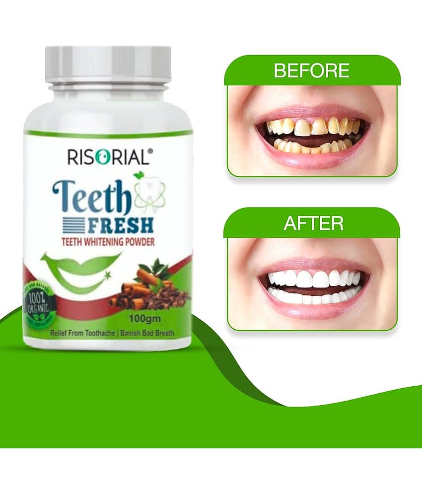 Risorial Teeth Whitening Denture Oral Kit