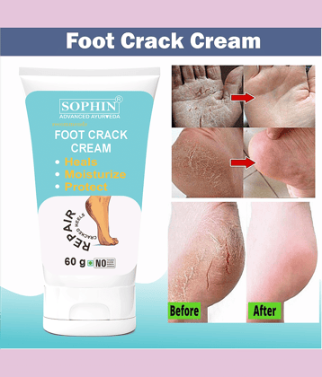 SOPHIN Cracked skin repair Cream for All year ( 60 g )