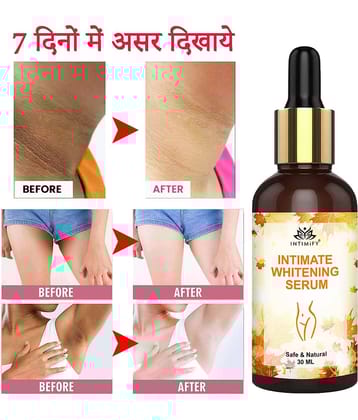 Intimify Intimate Area Whitening, Neck Whitening, Intimate Area Lightening V Tightening , 30 Ml