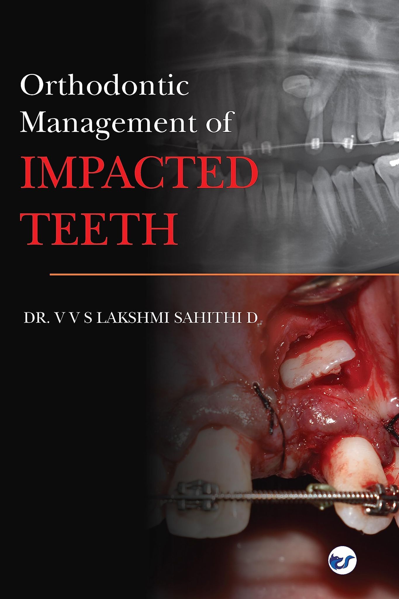 Orthodontic management of impacted teeth [Paperback] V V S Lakshmi Sahithi D