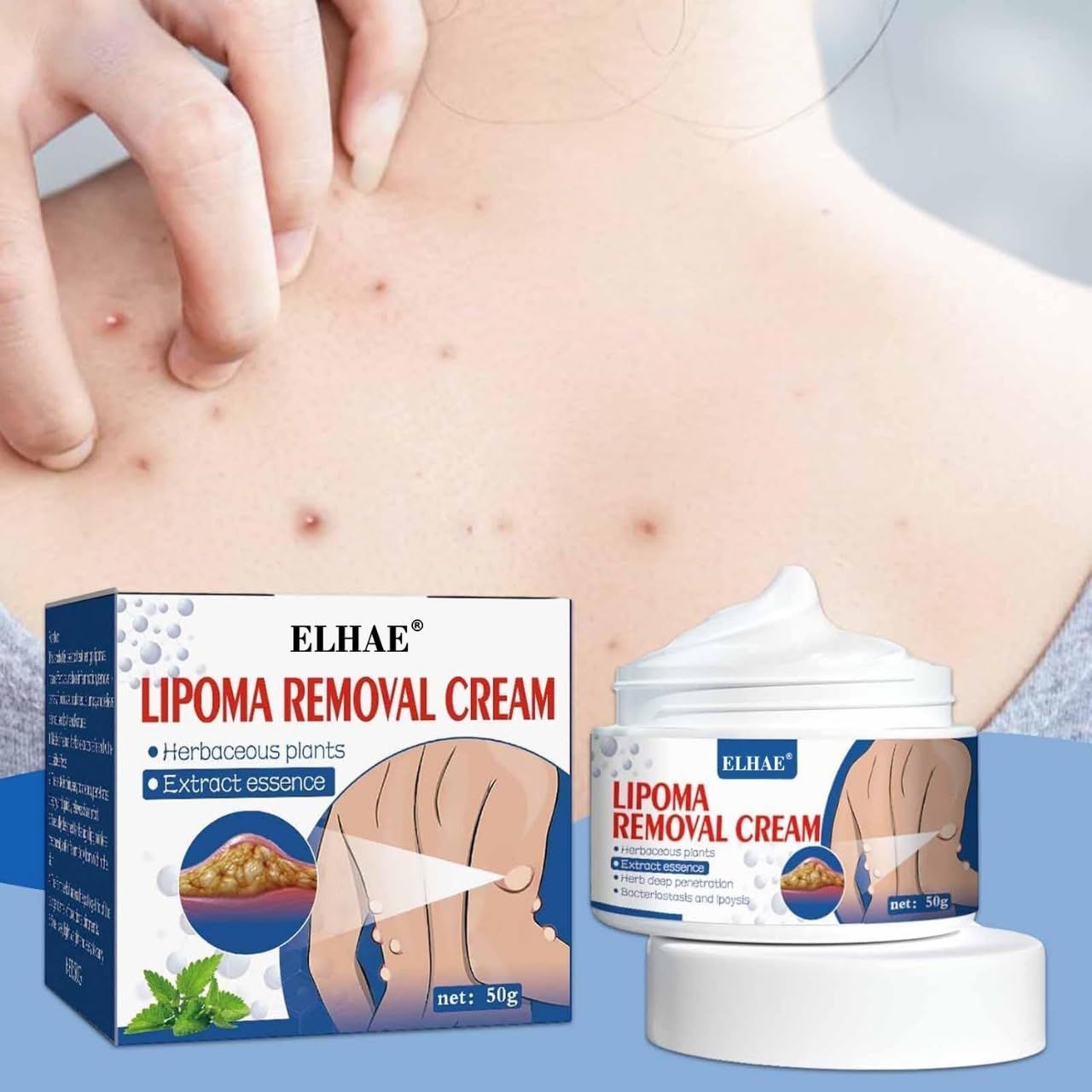 ELHAE Herbal Lipoma Cream Peeling Fat Mass Remove Miracle Ointment Safe Chinese Medicines Beauty Health Promotion