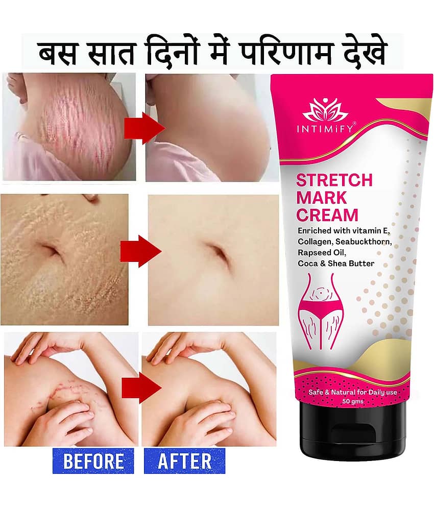 Intimify Stretch Mark Cream, Stretch Mark Remover Cream, Shaping & Firming Cream 50 gms