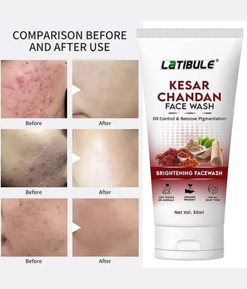 Latibule - Acne or Blemishes Removal Face Wash For All Skin Type ( Pack of 1 )