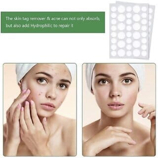 Acne Pimple Patch-Invisible Facial Stickers cover with 100 Hydrocolloid(18Dots) Acne Pimple Patch-Invisible Facial Stickers cover with 100 Hydrocolloid(18Dots)