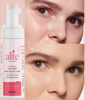 Alite - Acne or Blemishes Removal Face Wash For All Skin Type ( Pack of 1 )
