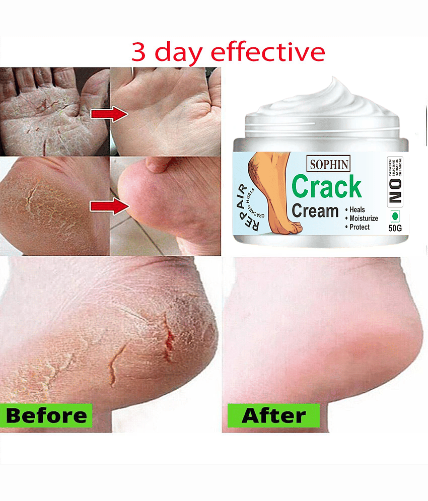 SOPHIN Cracked skin repair Cream for ( 50 g )
